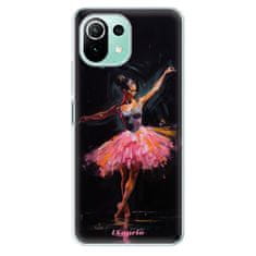 iSaprio Ballerina szilikon tok Xiaomi Mi 11 Lite