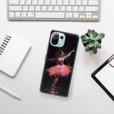 iSaprio Ballerina szilikon tok Xiaomi Mi 11 Lite