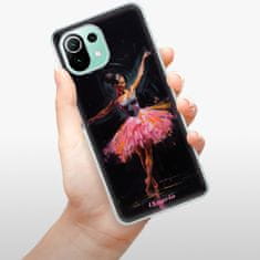 iSaprio Ballerina szilikon tok Xiaomi Mi 11 Lite