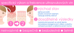 BeautyRelax BR-1150 Ultrahangos, fotonterápiás arckezelő készülék