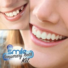 X TECH Instant Smile Kit - 30 db Ideiglenes szilikon foghelyettesítő 